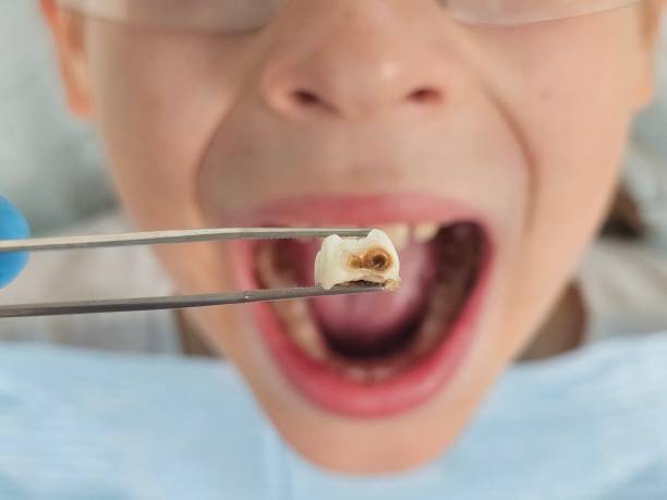 Best Weekend Emergency Dentist in Tamaqua, PA
